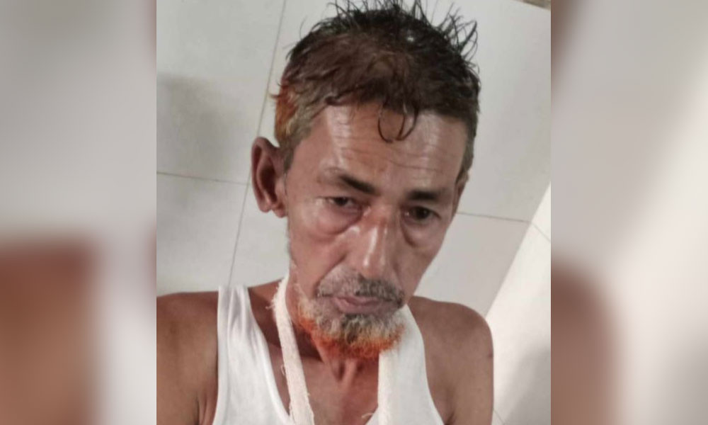 bhola-bnp-clash-ward-president-hand-severed